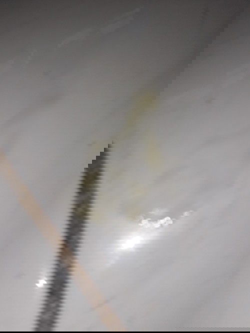 ketuban atau keputihan