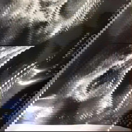 usg 4w kehamilan ke 2 setelah 3bulan lalu BO