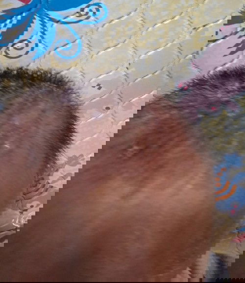 kerak di kepala bayi