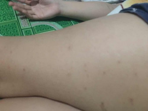 pregnant 11 weeks and 3 days