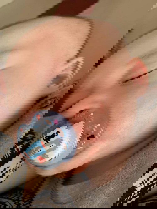 alergi akibat mpasi pertama