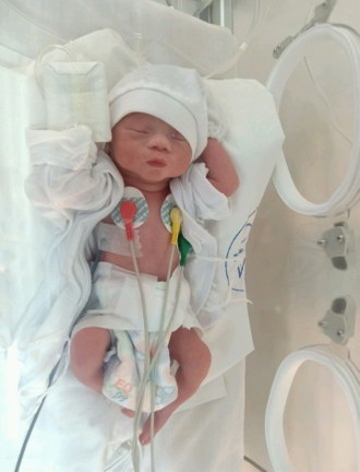 Meet My Miracle Premature Baby (32 weeks)👶❤