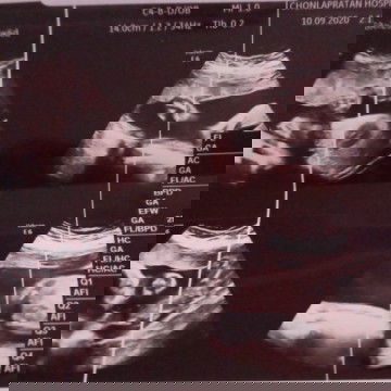 น้องไม่ไห้เห็นเพศเลย