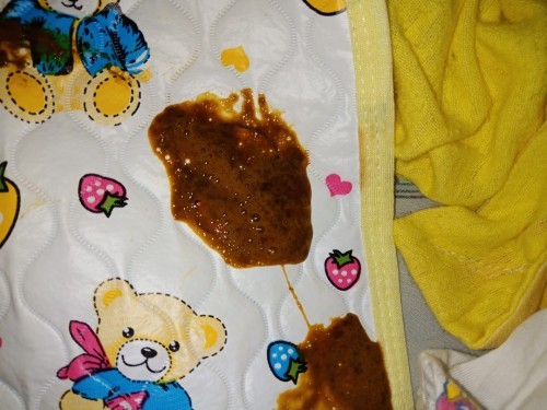 Poops ni Baby