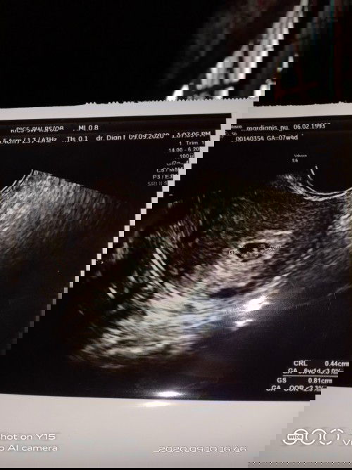 Usg transvaginal