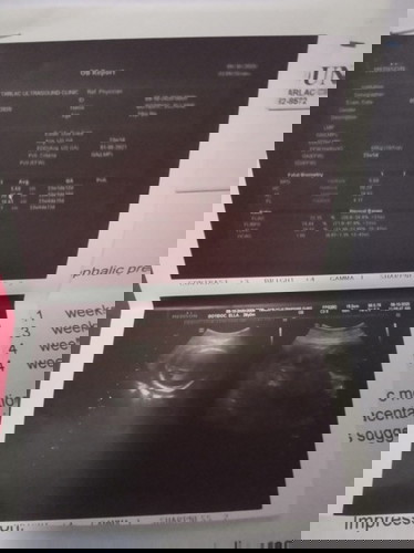 ultrasound