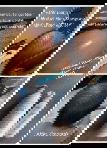 herbal hair shammpo & hair tonic Atomy