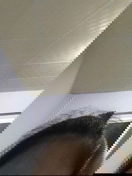 ผมหลังคลอด11เดือนก็จะประมาณนี้ใช่ไหมใครเป็นบ้าง