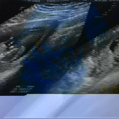 Assalamualaikum bunda...