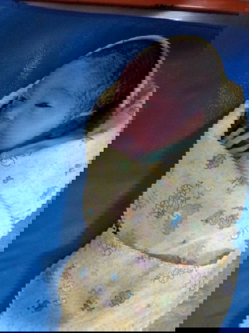 ketuban pecah dini di uk 36weeks