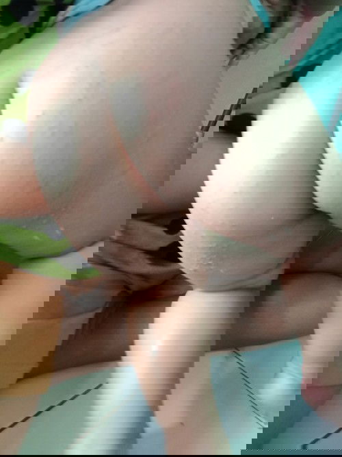 Bruntusan di badan bayi