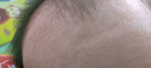 Mau nanyain beruntusan