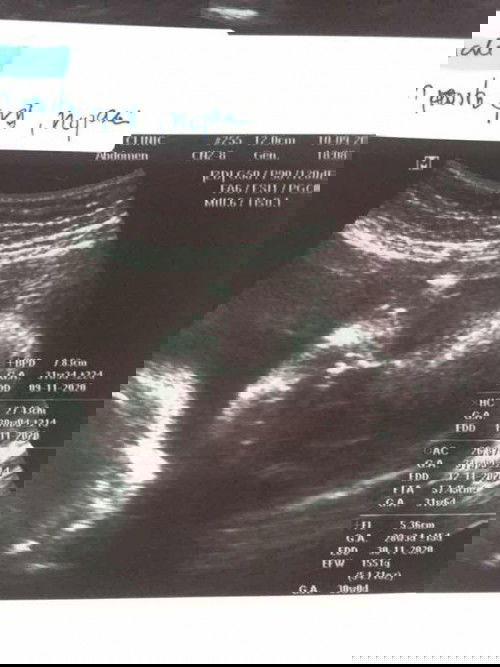 แม่ๆไปซาวคลินิกค่าใช้จ่ายเท่าไหร่ค่ะ