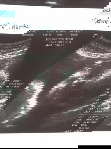 แม่ๆไปซาวคลินิกค่าใช้จ่ายเท่าไหร่ค่ะ
