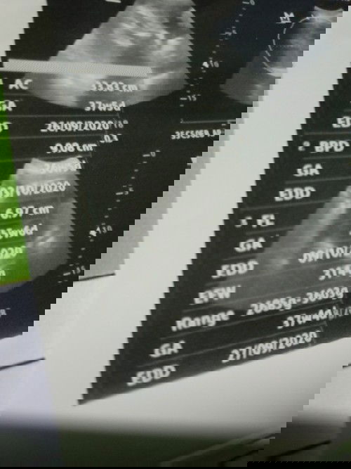 Minta doanya ya bunda-bunda cantik