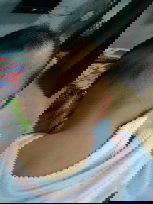 rambut anak tumbuh tidak rata