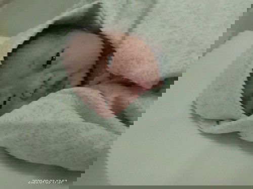 Sblm HPL bidan sudah lahir