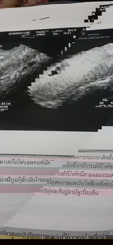 ขอดูใบซาวแม่ๆอายุครรภ์ 6วีคหน่อยจ้า