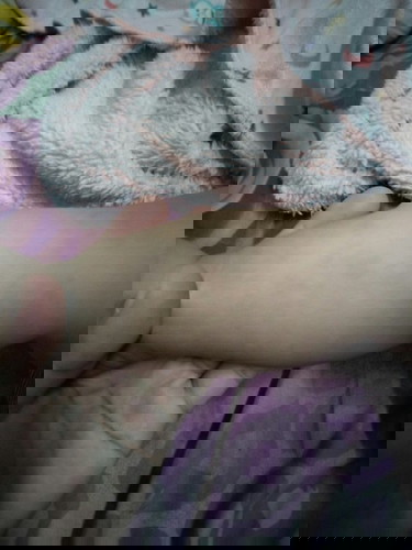 Kulit kaki kyk belang2