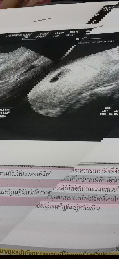 ซาวทางช่องคลอด