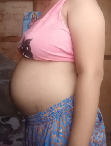 Baby Bump