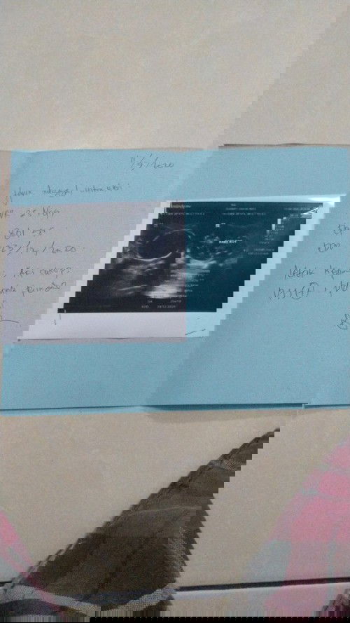 Tempat usg pada tutup karna covid