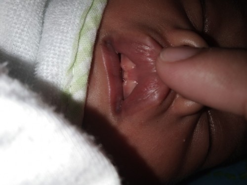 Liptie po ba anak ko ?