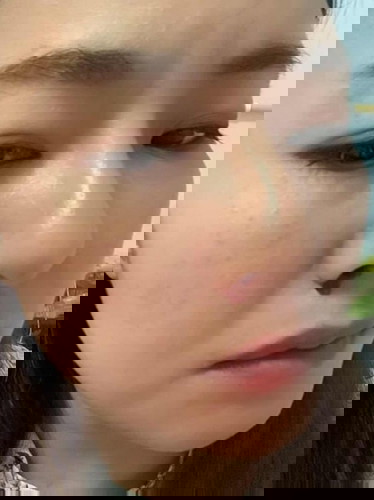 เลือดกำเดาไหล