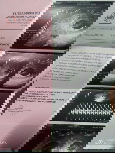 11 weeks of pregnancy for my second baby 😊