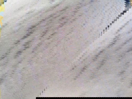 หลังคลอดท้องลายทำไงถึงหายค่ะ