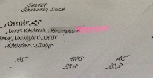 BBJ kurang atau normal