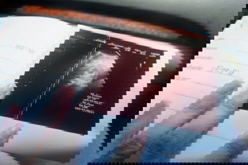 Chekup usia kandungan 6minggu