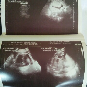 Boy or girl?