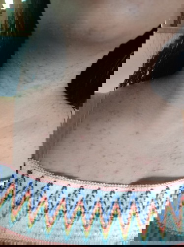 แม่ท้องคนไหนแพ้แบบนี้บ้างค่ะแล้วจะหายมั๊ยค่ะ