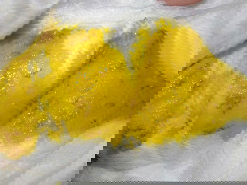 อึแบบนี้ปกติไหมคะ