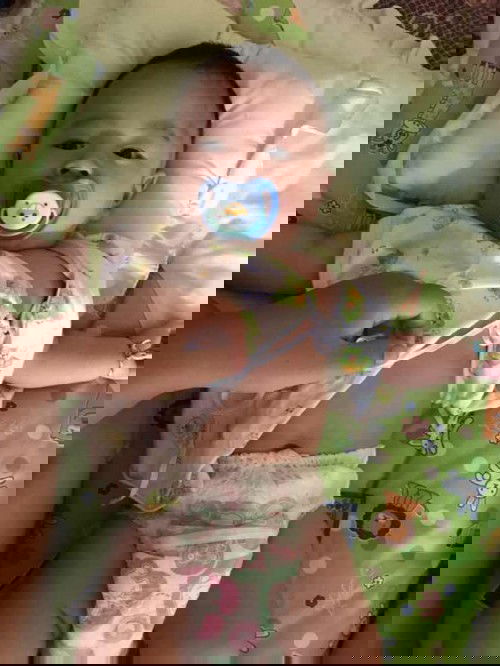 ใส่แพมเพิสขาโก่งหรอคะ