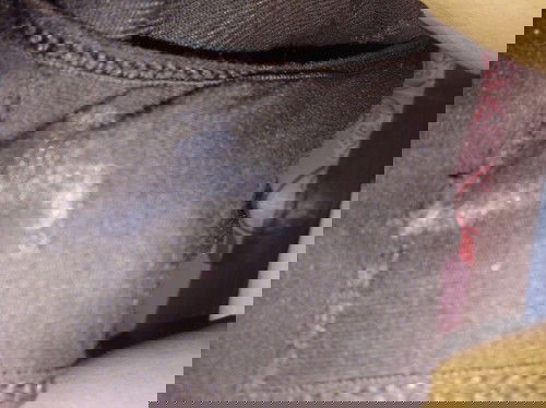 ท้องได้7เดือนมีคราบแบบนี้ติด กกน. อันตรายไหมคร่าคร่า