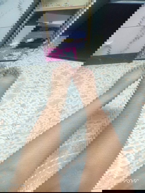 ขาบวม เท้าบวม