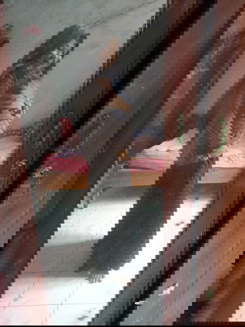 Jerawat rindu kah😅