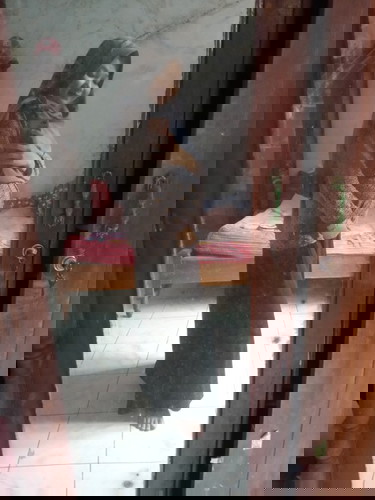 Jerawat rindu kah😅