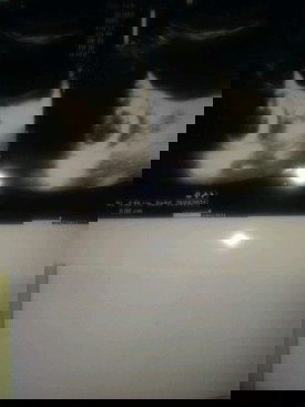 baca usg apakah aman?