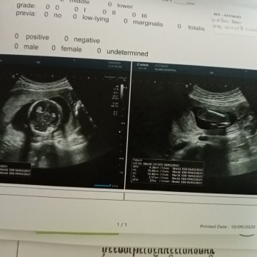 วันที่10ไปซาว์ดมา