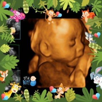 Normal gak sih bun usia kandungan 29W2d Bbj 1357