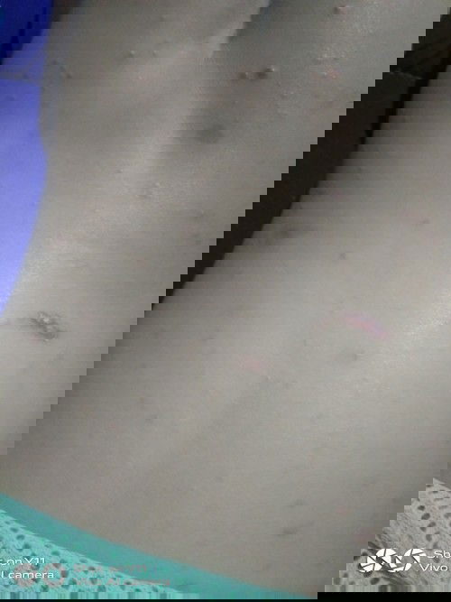 ขอคำแนะนำหรือวิธีรักษาหน่อยค่ะ