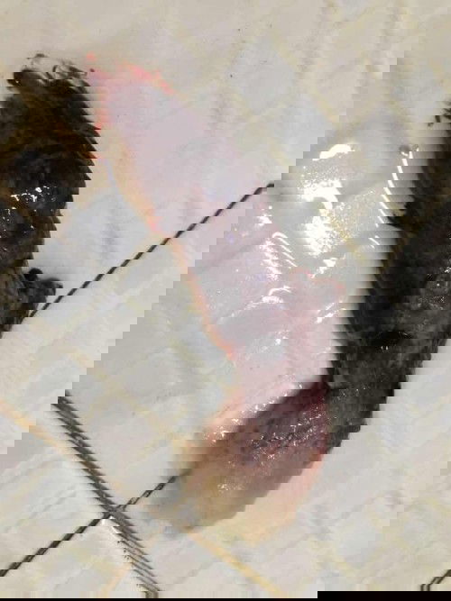 ท้องไม่รู้ตัว(ภาพอาจไม่น่าดู)