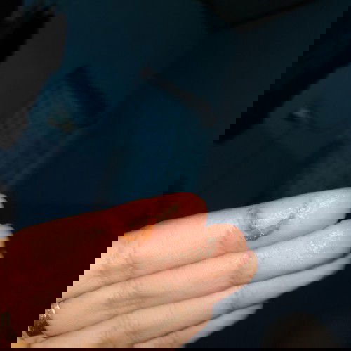 flek dikit. mohon bantu jawab.