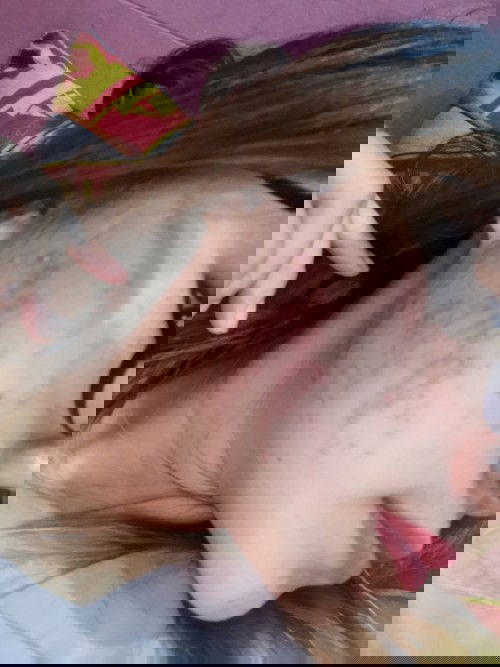 hilangin bekas jerawat utk bumil yg aman dan ampuh