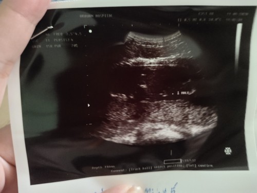 แม่ๆคนไหนได้ลูกชายบ้างคะขอดูรูปซาวหน่อยคะ