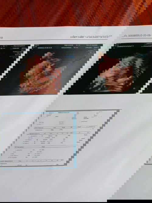 32W แล้วนะ