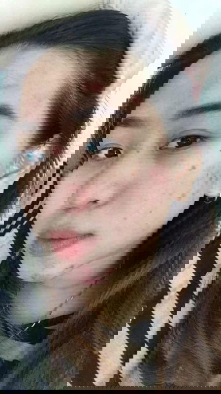 Wajah jerawatan dan kusam